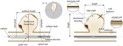 Review of intraluminal optical coherence tomography imaging for cerebral aneurysms